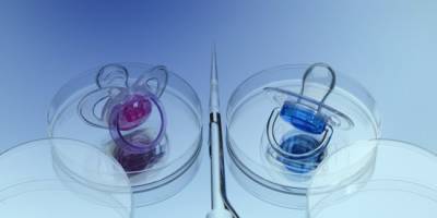 تعیین جنسیت با ای وی اف