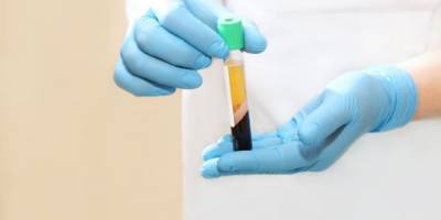 جوان  سازی بیضه با کمک prp